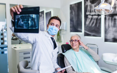 Implants dentaires vs. prothèses : Choisir la meilleure option de remplacement dentaire